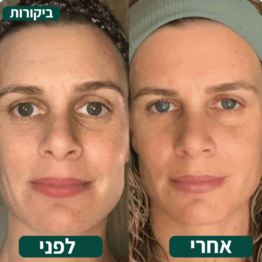 מכשיר לחיזוק ומיצוק עור הפנים מבית MOR-VEN