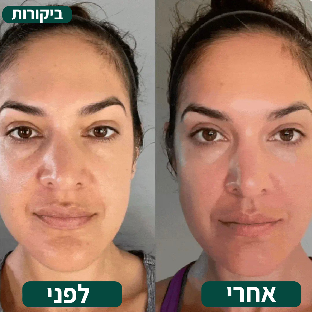 מכשיר לחיזוק ומיצוק עור הפנים מבית MOR-VEN