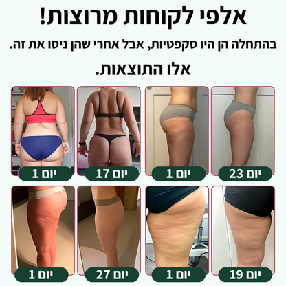 מכשיר עיסוי נגד צלוליט
